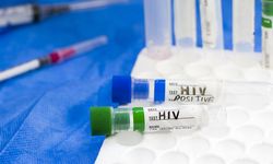 HIV/AIDS Tedavisi ve Hasta Bakımı