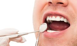 Periodontoloji ve Diş Eti Hastalıklarının Tedavisi