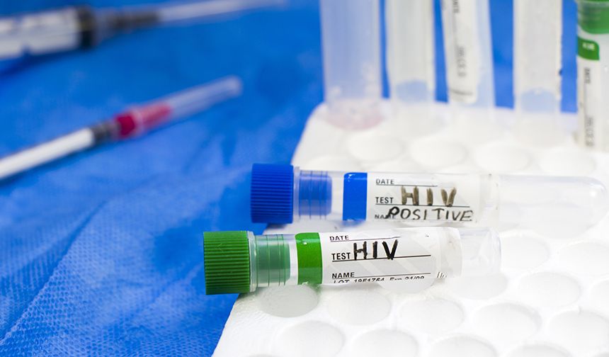 HIV/AIDS Tedavisi ve Hasta Bakımı